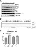 BACE1 Antibody in Western Blot (WB)