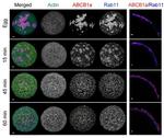 RAB11B Antibody in Immunohistochemistry (IHC)