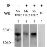 TPH2 Antibody in Immunoprecipitation (IP)