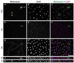 Opsin 4 Antibody in Immunohistochemistry (IHC)