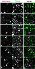 Opsin 4 Antibody in Immunohistochemistry (IHC)