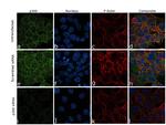 p300 Antibody in Immunocytochemistry (ICC/IF)