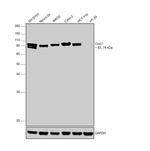 ChAT Antibody in Western Blot (WB)