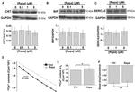 Calreticulin Antibody in Western Blot (WB)