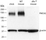 PMCA2 ATPase Antibody in Western Blot (WB)