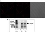 KCNMA1 Antibody in Immunocytochemistry (ICC/IF)