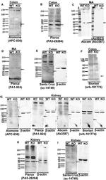 KCNMB1 Antibody in Western Blot (WB)