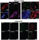 CFTR Antibody in Immunocytochemistry (ICC/IF)