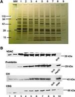 VDAC Antibody in Western Blot (WB)