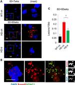 VDAC Antibody in Immunocytochemistry (ICC/IF)