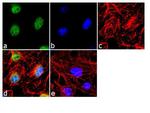 TRAIL-R2 (DR5) Antibody in Immunocytochemistry (ICC/IF)