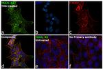 TRAIL-R2 (DR5) Antibody in Immunocytochemistry (ICC/IF)