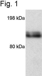 iNOS Antibody in Western Blot (WB)