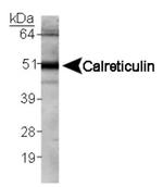 Calreticulin Antibody in Western Blot (WB)