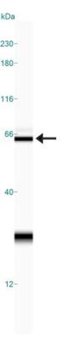 Calreticulin Antibody in Western Blot (WB)