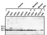 PRDX1 Antibody in Western Blot (WB)