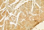 Kindlin 2 Antibody in Immunohistochemistry (Paraffin) (IHC (P))