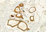 Kindlin 2 Antibody in Immunohistochemistry (Paraffin) (IHC (P))