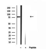 Kindlin 2 Antibody in Western Blot (WB)