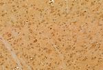 SKAP2 Antibody in Immunohistochemistry (Paraffin) (IHC (P))