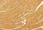 SKAP2 Antibody in Immunohistochemistry (Paraffin) (IHC (P))