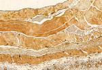 SKAP2 Antibody in Immunohistochemistry (Paraffin) (IHC (P))