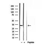 SULT4A1 Antibody in Western Blot (WB)