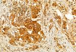 AdoHcyase 2 Antibody in Immunohistochemistry (Paraffin) (IHC (P))