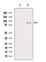 BBS2 Antibody in Western Blot (WB)