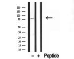 BBS2 Antibody in Western Blot (WB)