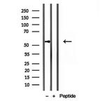 KMO Antibody in Western Blot (WB)