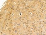 MPV17 Antibody in Immunohistochemistry (Paraffin) (IHC (P))