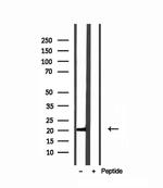 MPV17 Antibody in Western Blot (WB)