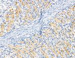 PDLIM7 Antibody in Immunohistochemistry (Paraffin) (IHC (P))