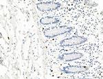 PDLIM7 Antibody in Immunohistochemistry (Paraffin) (IHC (P))