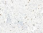 PDLIM7 Antibody in Immunohistochemistry (Paraffin) (IHC (P))