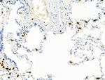 PDLIM7 Antibody in Immunohistochemistry (Paraffin) (IHC (P))