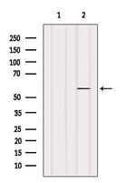 PDLIM7 Antibody in Western Blot (WB)