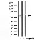 PDLIM7 Antibody in Western Blot (WB)