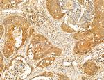 PYGL Antibody in Immunohistochemistry (Paraffin) (IHC (P))