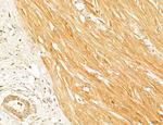 PYGL Antibody in Immunohistochemistry (Paraffin) (IHC (P))