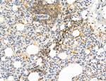 PYGL Antibody in Immunohistochemistry (Paraffin) (IHC (P))