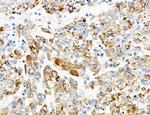 PYGL Antibody in Immunohistochemistry (Paraffin) (IHC (P))