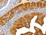 PYGL Antibody in Immunohistochemistry (Paraffin) (IHC (P))