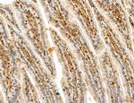 PYGL Antibody in Immunohistochemistry (Paraffin) (IHC (P))