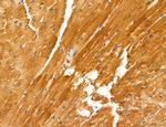 PYGL Antibody in Immunohistochemistry (Paraffin) (IHC (P))