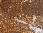 PYGL Antibody in Immunohistochemistry (Paraffin) (IHC (P))