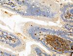 PYGL Antibody in Immunohistochemistry (Paraffin) (IHC (P))