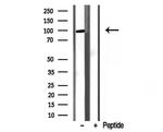 PYGL Antibody in Western Blot (WB)