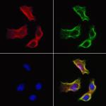 SULT1E1 Antibody in Immunocytochemistry (ICC/IF)